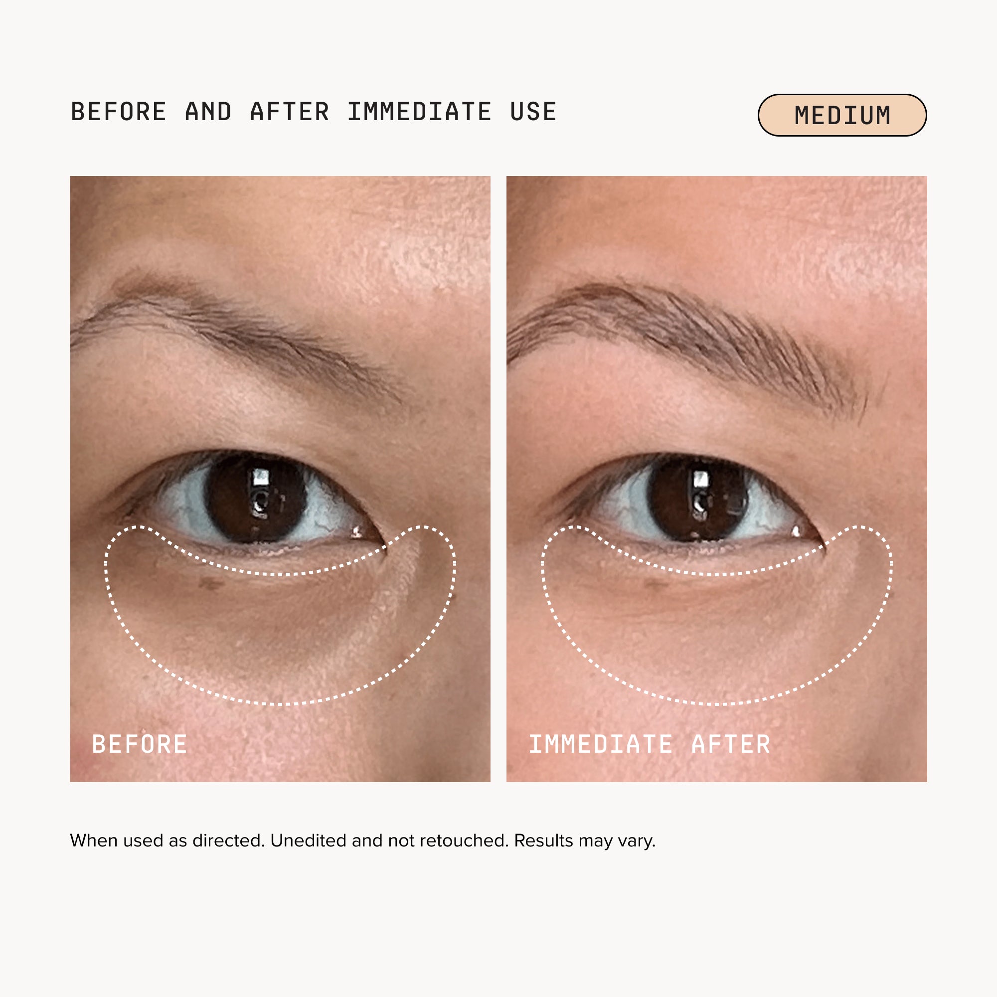 07Before_After-medium_ec72ad23-96f3-4236-952f-523fc834a51a.jpg